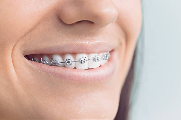 Best Invisalign and Clear Aligners  in Mount Ivy, NY